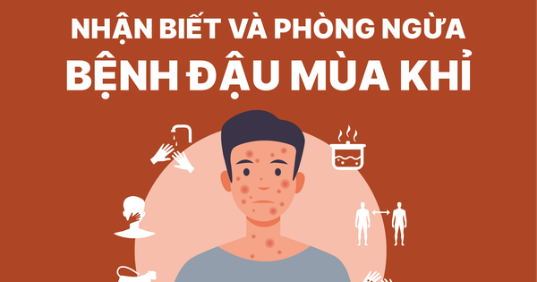 Những điều cần biết về bệnh đậu mùa khỉ và cách phòng tránh