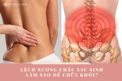 Lệch xương chậu sau sinh làm sao để chữa khỏi?